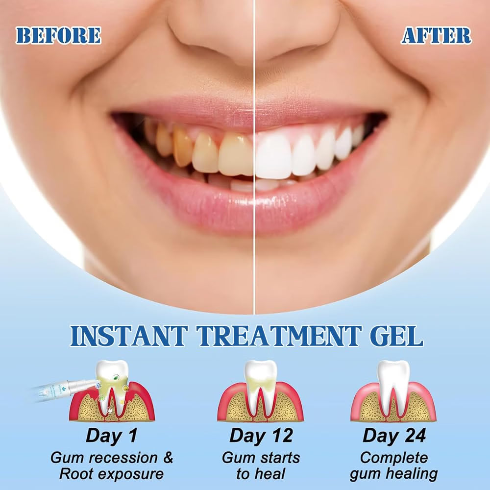 ELYCURA GUM PROTECT DENTAL GEL PEN ORAL CARE THERAPY REDUCE INFLAMMATION EXP 2029