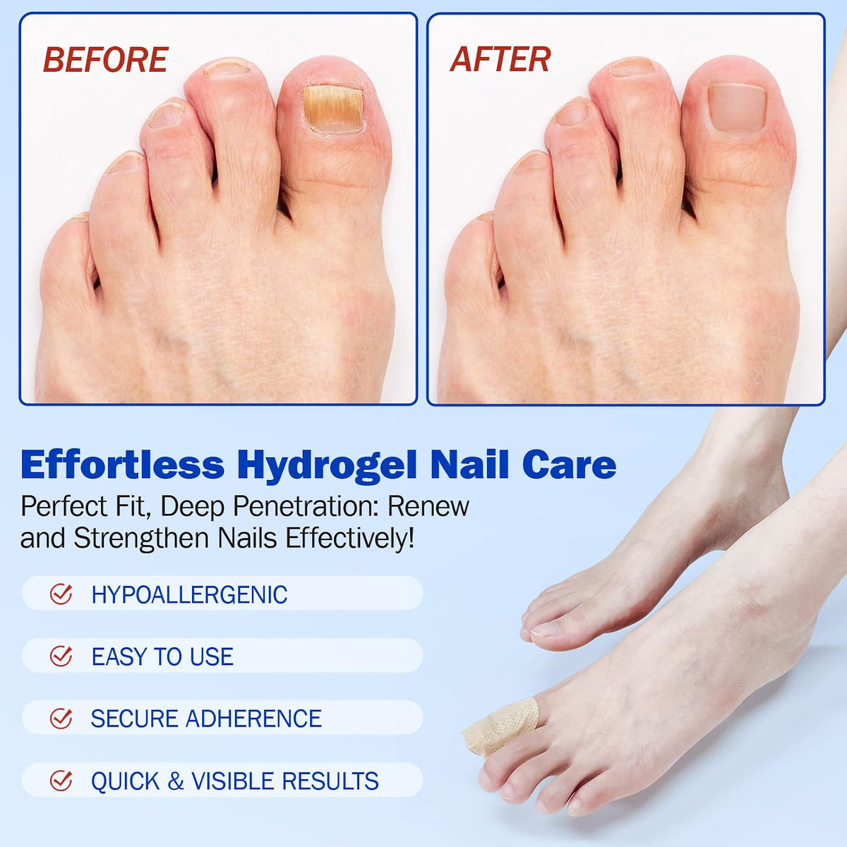 FUNGAL NAIL PATCHES 21PCS EXTRA STRENGTH OVERNIGHT HYDROGEL REPAIR