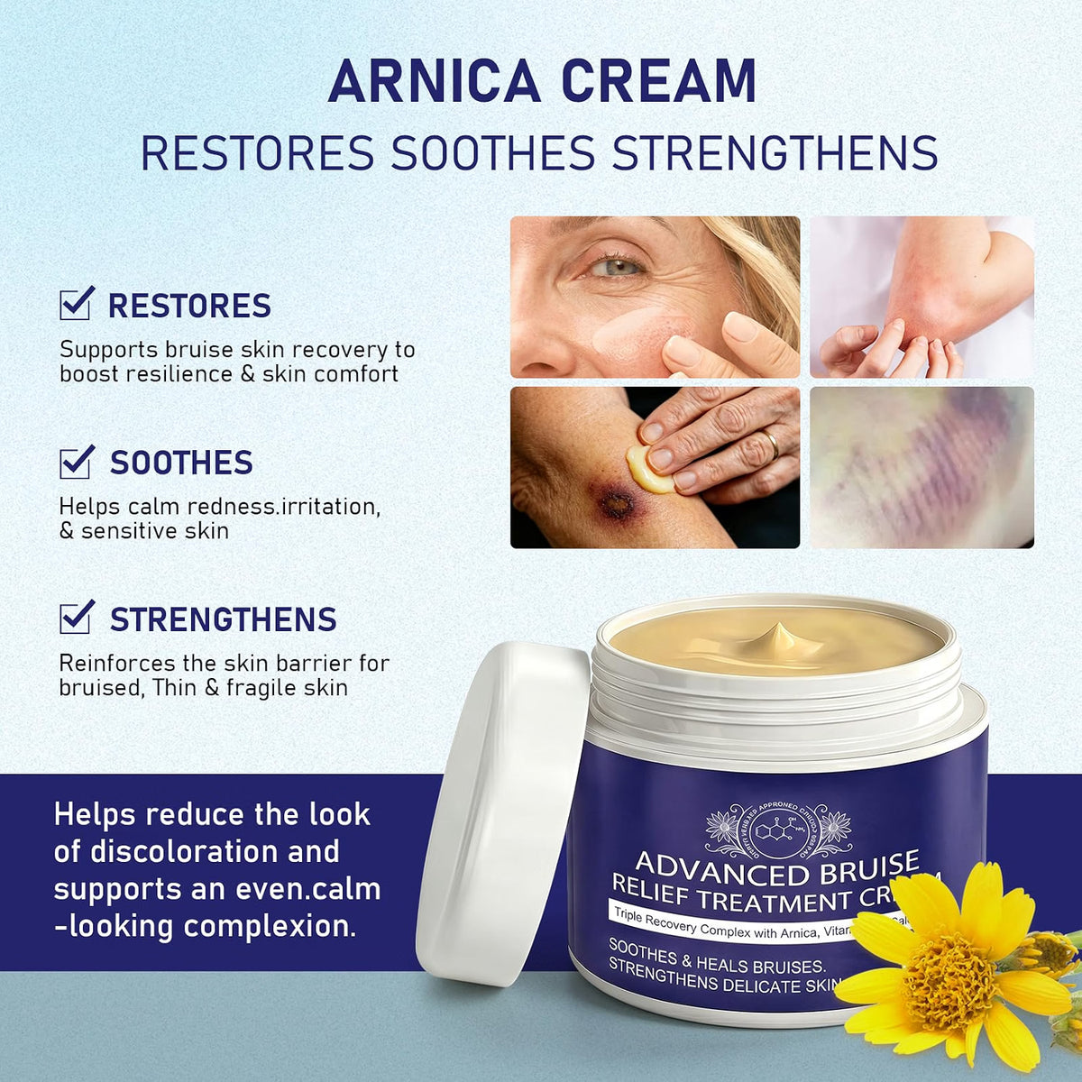 BRUISE REPAIR & SKIN CREAM WITH ARNICA, VITAMIN K, CALENDULA 4OZ SOOTHES/HEALS