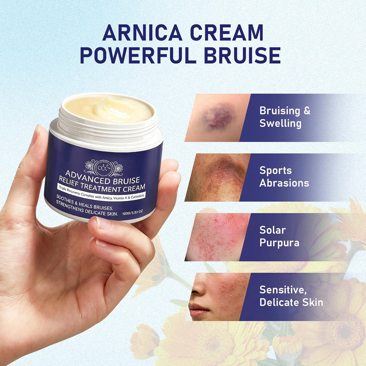 BRUISE REPAIR & SKIN CREAM WITH ARNICA, VITAMIN K, CALENDULA 4OZ SOOTHES/HEALS