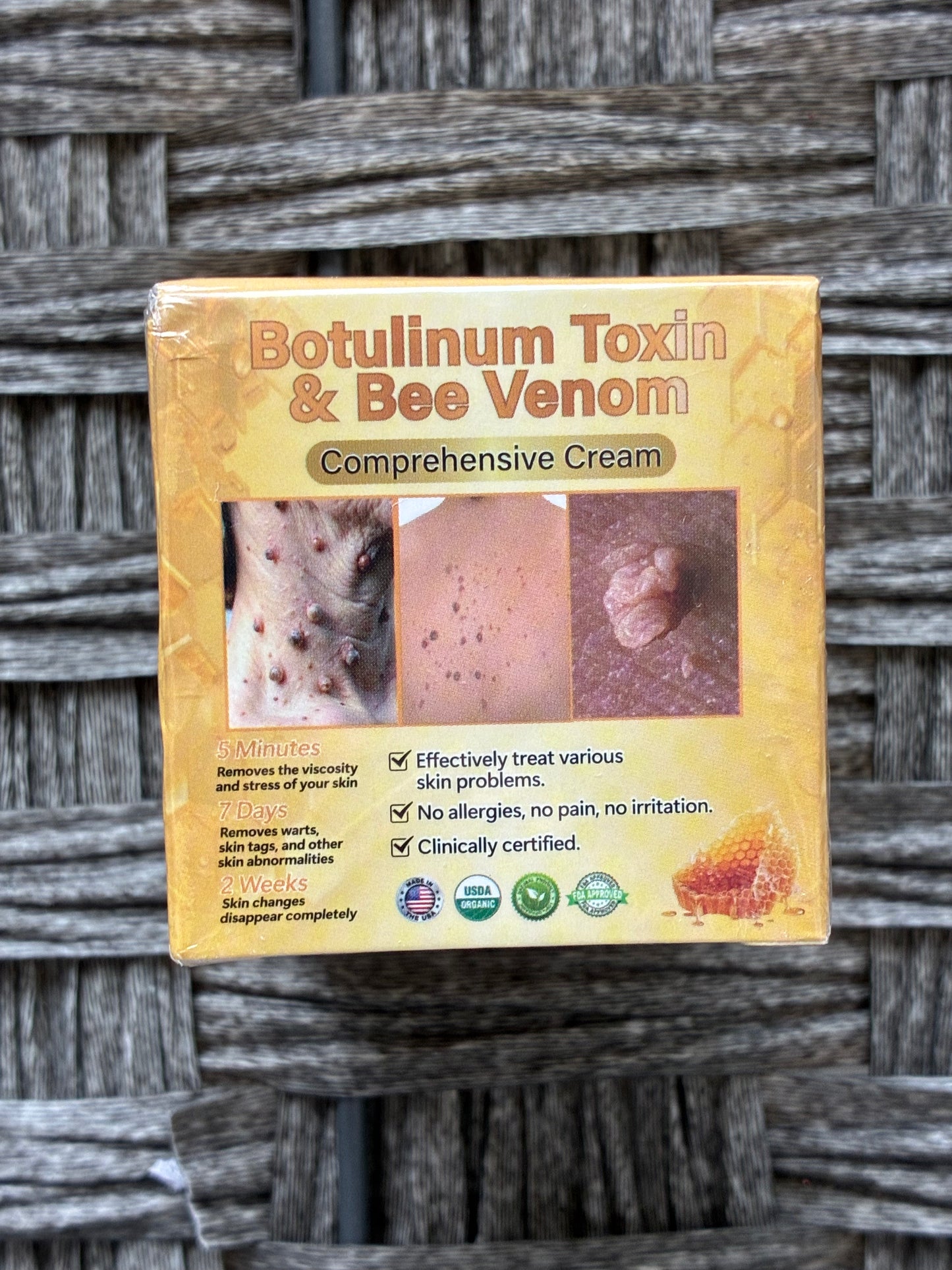 BOTULINUM TOXIN & BEE VENOM CREAM SKIN TAG WART ABNORMALITIES REMOVER EXPP 04/28